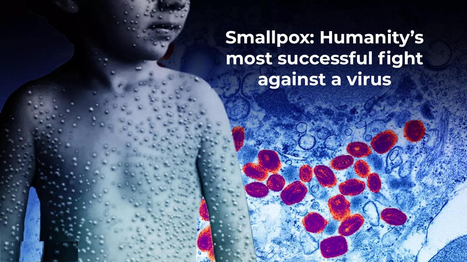 smallpox-32ec969f