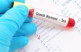 Growth Hormone Deficiency Market-7fb5fae7