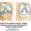 Knee Implants Market - Bharat Book Bureau-faae3d6c
