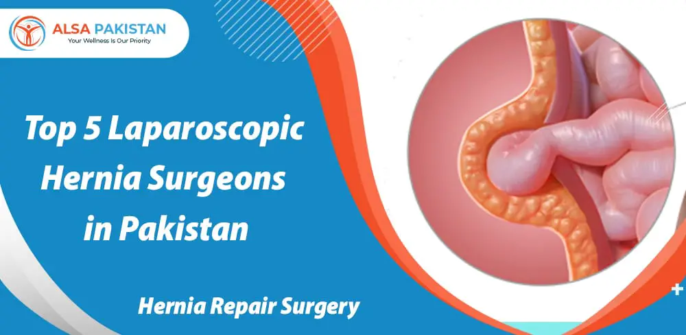 Top-5-Laparoscopic-Hernia-Surgeons-in-Pakistan-Hernia-repair-surgery-7ac5e023