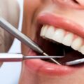 dentistry-blog-33945d51