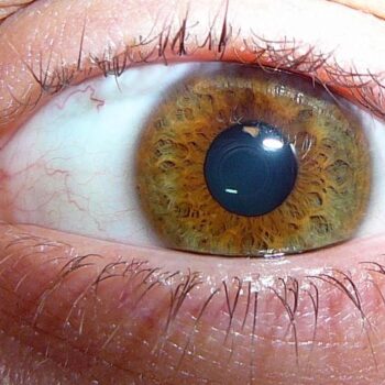 eye-melanoma-e7453315