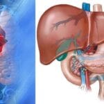 hepatocellular-carcinoma-2-728-e0beebd2