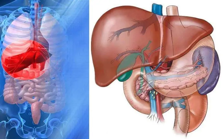 hepatocellular-carcinoma-2-728-e0beebd2