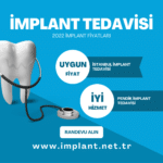 implanttedavi-77ae9529
