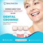 Dental-Crowns!-fe04b096