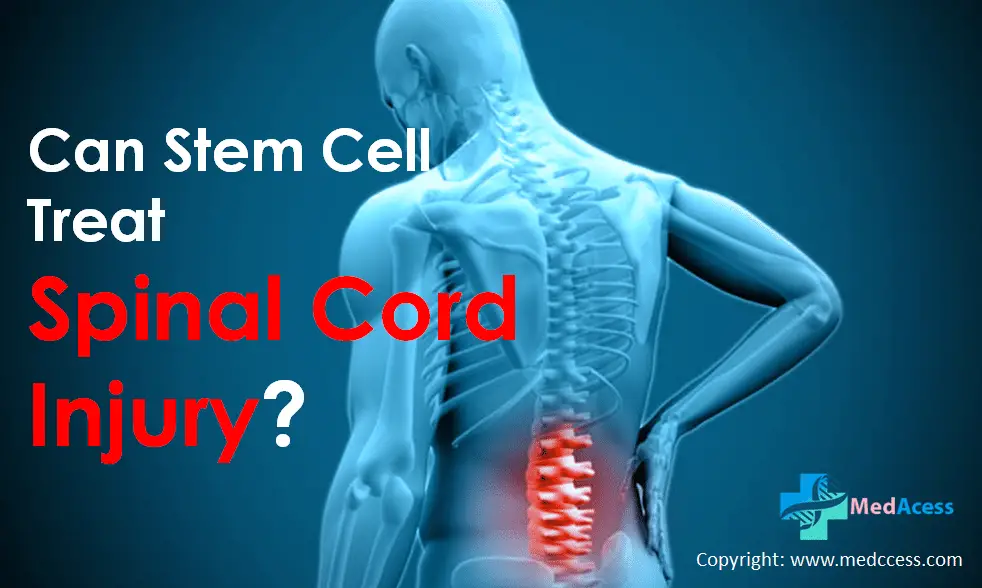 Zero Waiting Time Stem Cell Spinal Cord Injury Treatment in India attracts global patients-c65d4577