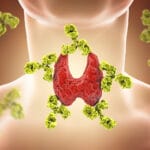 autoimmune-disease-blog-3d955345