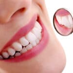 Benefits of Seeing A Cosmetic Dentist-e13c3485