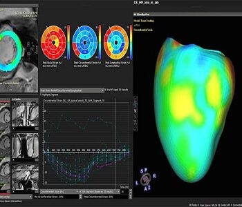India Cardiac Medical Imaging Software Market - TechSci Research-353d021d