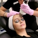 Skin-Refereshing-ThermaFrax-Laser-treatments-scaled-10d620f3