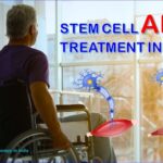 Stem Cell ALS Treatment In India-a233b250