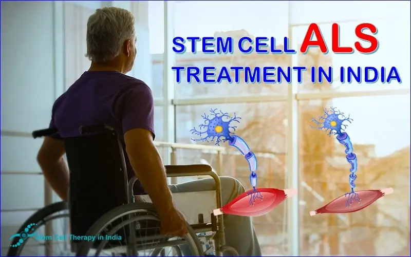 Stem Cell ALS Treatment In India-a233b250