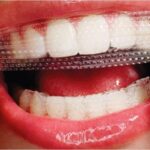 Teeth Whitening Strips Market - TechSci Research-105f15a5