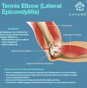Tennis Elbow Therapy-2775b4c4