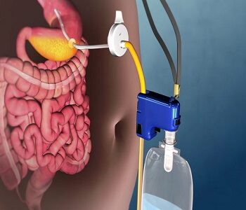 UAE Bariatric Surgical Devices Market - TechSci Research-c4a992c2