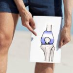 Total knee replacement in India - Shalby Hospitals-4fd2d4e1