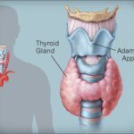 thyroid1-44acc16b
