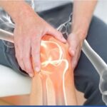 Total knee replacement in India - Shalby Hospitals
