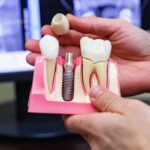 Dental Implant Training Courses-6caa60ce