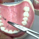 Dental Suture-270cdead