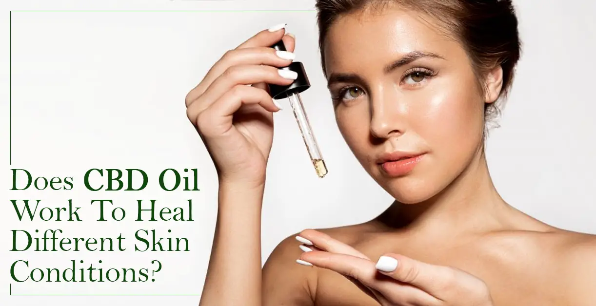 Does CBD Oil Work To Heal Different Skin Conditions-65615632