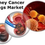 Kidney Cancer Drugs Market-Growth Market Reports-8b43f69f