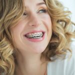 5-Reasons-Getting-Braces-as-an-Adult-Can-Make-You-Happier-961818b0