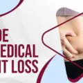 A guide for Medical Weight Loss (1)-b057afe1