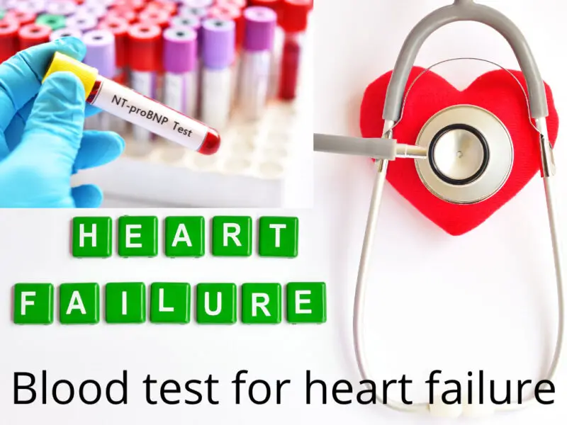 blood-tests-to-diagnose-heart-failure-writeupcafe