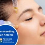 Microneedling San Antonio-c36cc7a1