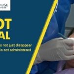 Root Canal Specialist Toronto (2)-eb1fa692
