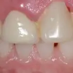 Teeth-29574ddc