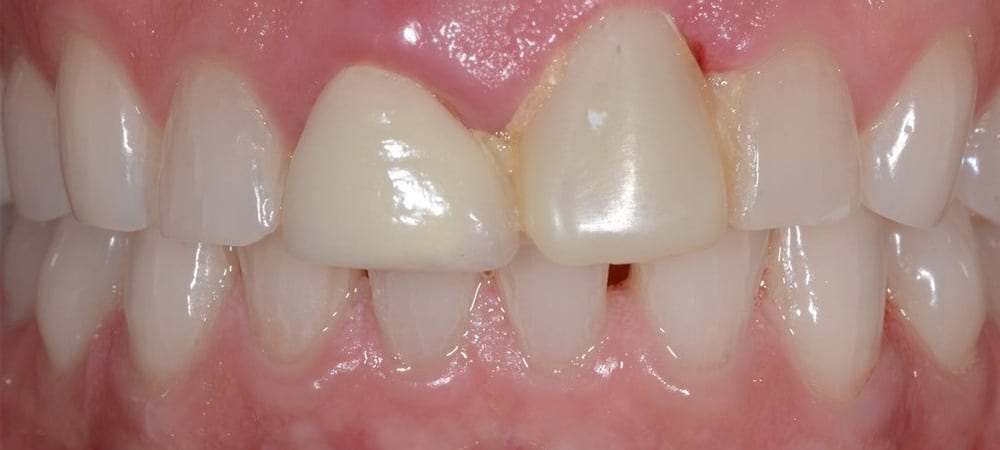 Teeth-29574ddc