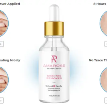 Amarose Skin Tag Remover2-63b054bf