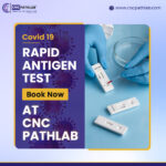 Rapid antigen test delhi-26a1ecb2