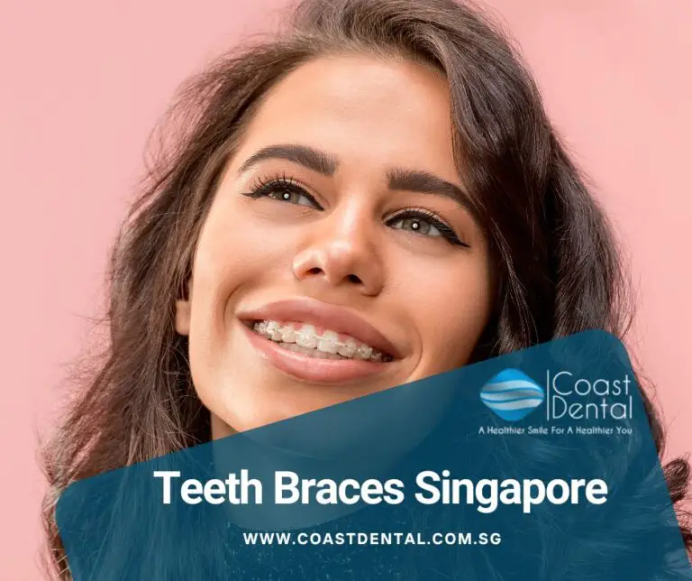 Teeth Braces Singapore