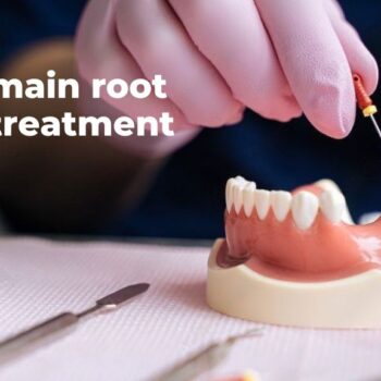 The 7 main root canal treatment steps-f45b4d68