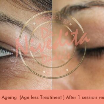 before-after-anti-aging-020618-5c60062d