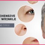 A Comprehensive Guide on Wrinkle (3)-cc5ed0f1