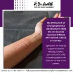 skin-writing rash-9b822cda