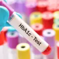 HbA1c Testing-42c275e7
