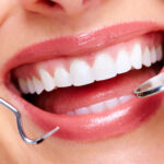 cosmetic-dentistry-in-Murfreesboro-07e99907