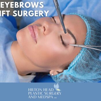 eyebrows lift surgery-638cd4bc
