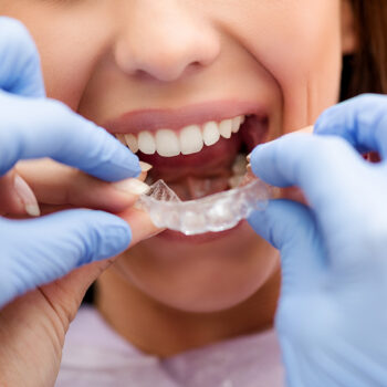 orthodontist-with-invisalign-patient-3815d81f