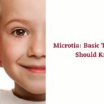 Microtia Basic Things One Should Know-0b7967dc