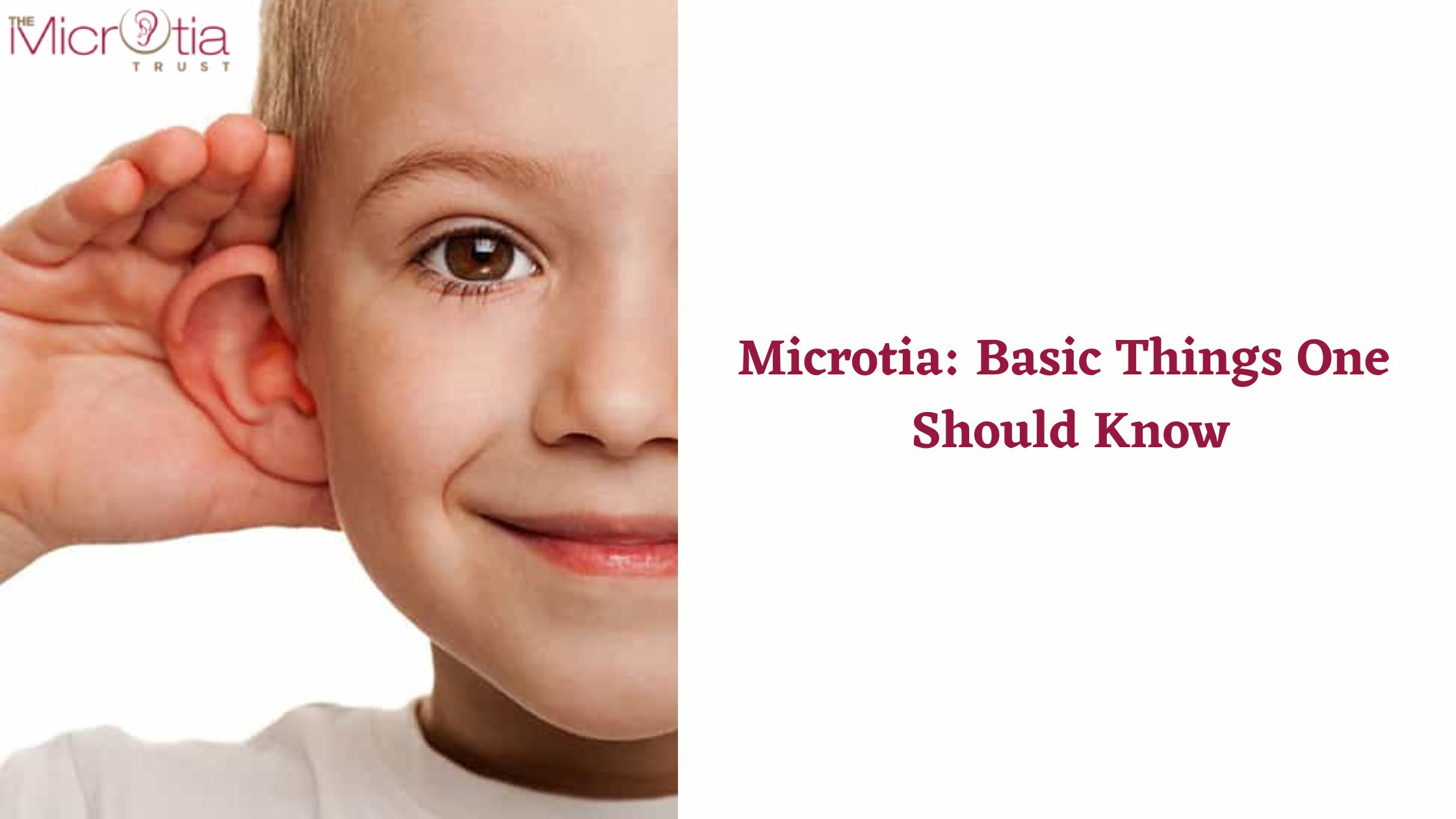 Microtia Basic Things One Should Know-0b7967dc