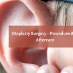 Otoplasty Surgery - Procedure And Aftercare-6990ebca