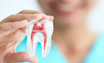 Root-Canal-Treatment-in-Gurgaon-RCT-of-Teeth-in-Gurgaon-Alveo-Dental (2)-94bc002c