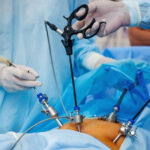 laparoscopy_surgery-fd37a801